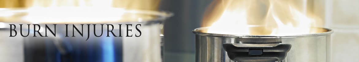 burn injury atlanta attorney