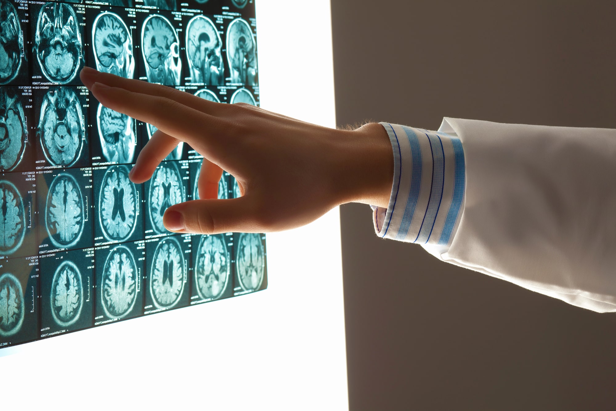 What Steps Should I Take After a Brain Injury?